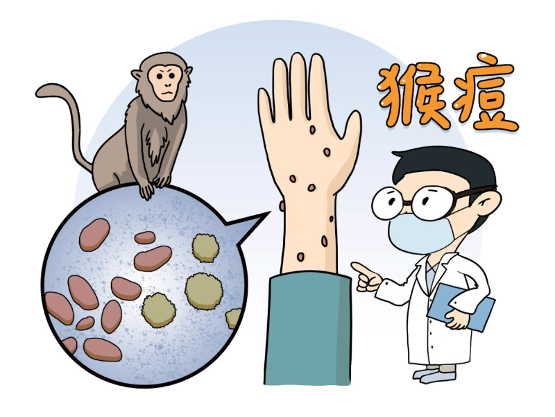 猴痘 猴痘