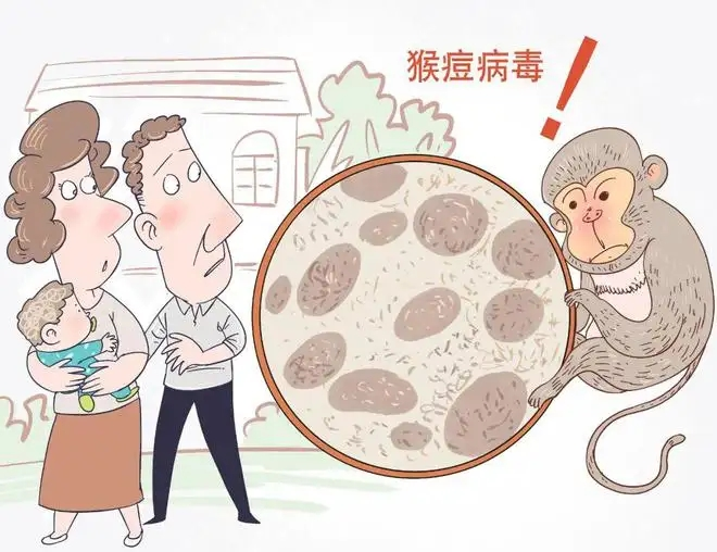 猴痘病毒 猴痘病毒